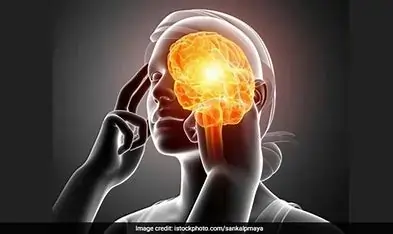 NeuroSharp Supplement Bottle